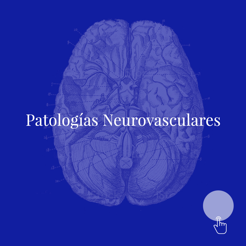 Patología neurovascular